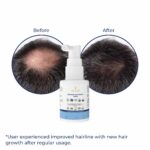 TRULIVA Hair Serum for Men & Women with Redensyl, Anagain & Baicapil | Boosts New Hair Growth, Reduces Hair Fall up  | Strengthens Follicles | Dermatologically Tested | Non-Sticky – 30ml - Image 7