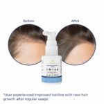 TRULIVA Hair Serum for Men & Women with Redensyl, Anagain & Baicapil | Boosts New Hair Growth, Reduces Hair Fall up  | Strengthens Follicles | Dermatologically Tested | Non-Sticky – 30ml - Image 8