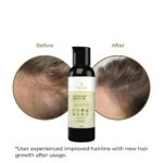 TRULIVA Hair Oil For Men & Women | Promotes Hair Growth & Reduces Hair Fall | With Rosemary, Castor, Amla, Coconut, Onion and Bhringraj Oil | Mineral Oil Free | 100 ml - Image 4