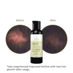 TRULIVA Hair Oil For Men & Women | Promotes Hair Growth & Reduces Hair Fall | With Rosemary, Castor, Amla, Coconut, Onion and Bhringraj Oil | Mineral Oil Free | 100 ml - Image 3